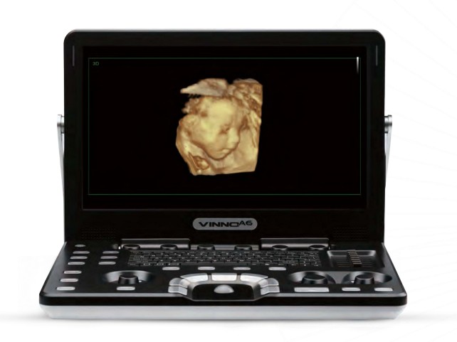 VINNO A6 Ultrasound System