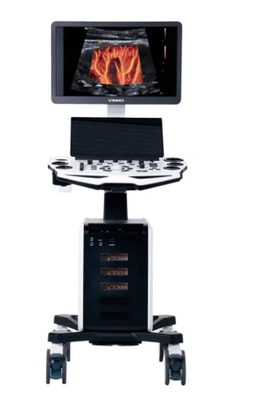 VINNO S100 Ultrasound view 3