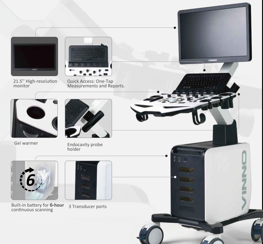 VINNO S100 Ultrasound view 4